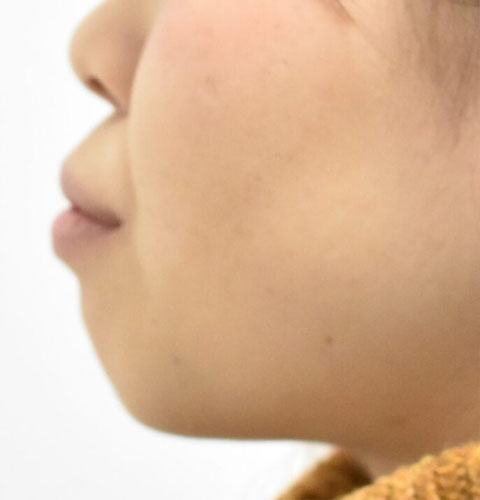 治療前